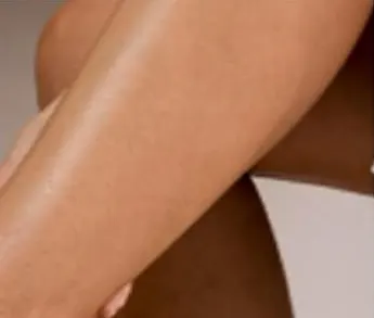 Piernas con la piel lisa tras la depilación láser